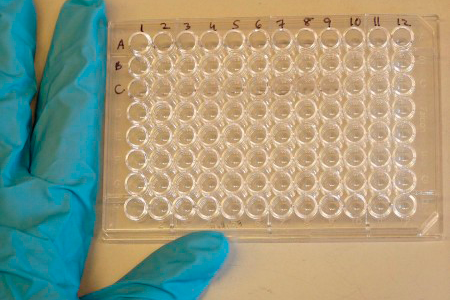 O teste imunoenzimático do tipo ELISA pode ser adaptado para outras tecnologias automatizadas e testes rápidos do tipo point of care (foto: Jeffrey M. Vinocur/Wikimedia Commons)